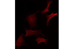 ABIN6275400 staining Hela by IF/ICC. (ZDHHC20 antibody  (Internal Region))