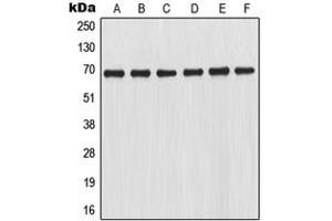 Western blot analysis of NRF2 expression in THP1 (A), HL60 (B), K562 (C), Jurkat (D), mouse kidney (E), rat kidney (F) whole cell lysates. (NRF2 antibody  (C-Term))