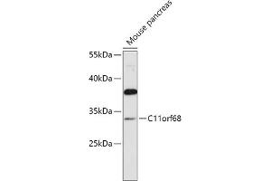 Western blot analysis of extracts of Mouse pancreas, using C11orf68 antibody (ABIN7266371) at 1:1000 dilution. (C11orf68 antibody  (AA 42-292))