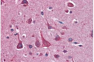 Human Brain, Cortex (formalin-fixed, paraffin-embedded) stained with YWHAQ antibody ABIN364361 at 10 ug/ml followed by biotinylated anti-mouse IgG secondary antibody ABIN481714, alkaline phosphatase-streptavidin and chromogen. (14-3-3 theta antibody  (AA 1-245))