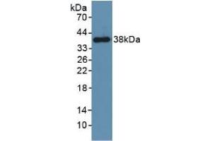 Western blot analysis of recombinant Mouse PDGFRb. (PDGFRB antibody  (AA 337-583))