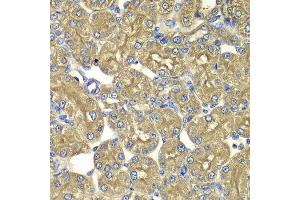 Immunohistochemistry of paraffin-embedded rat kidney using PSMD5 antibody at dilution of 1:100 (x400 lens).