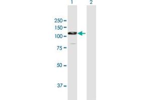 Western Blot analysis of CTNNA2 expression in transfected 293T cell line by CTNNA2 MaxPab polyclonal antibody.