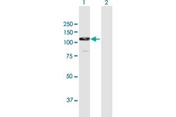 CTNNA2 antibody  (AA 1-905)