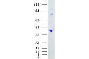 Validation with Western Blot