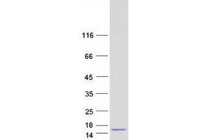 Catenin, beta Interacting Protein 1 (CTNNBIP1) (Transcript Variant 2) protein (Myc-DYKDDDDK Tag)