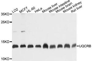 Western blot analysis of extracts of various cells, using UQCRB antibody. (UQCRB antibody)