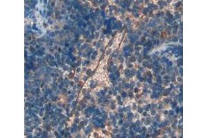 Immunohistochemistry (IHC) image for anti-Selectin L (SELL) (AA 94-332) antibody (ABIN1860513)