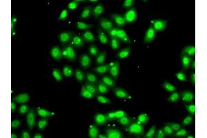 Immunofluorescence analysis of U2OS cells using PI antibody . (PIAS3 antibody  (AA 399-628))