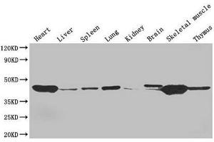Western Blot Positive WB detected in: Mouse heart tissue, Mouse liver tissue, Mouse spleen tissue, Mouse lung tissue, Mouse kidney tissue, Mouse brain tissue, Mouse skeletal muscle tissue, Mouse thymus tissue All lanes: ACTA1 antibody at 4 μg/mL Secondary Goat polyclonal to rabbit IgG at 1/50000 dilution Predicted band size: 43 kDa Observed band size: 43 kDa