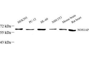 Western blot analysis of NOS1AP (ABIN7074844) at dilution of 1: 1000 (NOS1AP antibody)