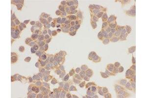 ICC testing of HSP90 antibody and MCF-7 cells (HSP90AA1 antibody  (AA 2-365))