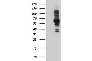 Western Blotting (WB) image for anti-PDZ and LIM Domain 5 (PDLIM5) antibody (ABIN1500131)