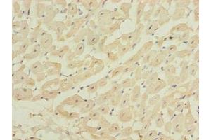 Immunohistochemistry of paraffin-embedded human heart tissue using ABIN7175990 at dilution of 1:100 (ZBTB6 antibody  (AA 115-424))