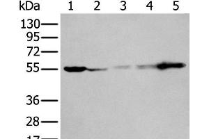 Western blot analysis of 293T A549 A431 Hela and Jurkat cell lysates using PFKFB3 Polyclonal Antibody at dilution of 1:400 (PFKFB3 antibody)