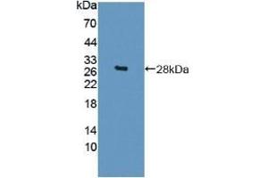 Detection of Recombinant Sp17, Mouse using Polyclonal Antibody to Sperm Protein 17 (Sp17) (SPA17 antibody  (AA 1-149))