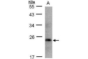 WB Image Sample(30 ug whole cell lysate) A:293T 12% SDS PAGE antibody diluted at 1:1000 (Growth Hormone 1 antibody)