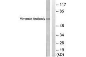 Western blot analysis of extracts from HepG2 cells, treated with Adriamycin 0. (Vimentin antibody  (AA 411-460))