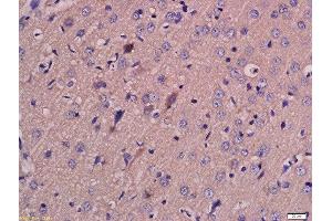 Formalin-fixed and paraffin embedded rat brain labeled with Anti-MCT4 Polyclonal Antibody, Unconjugated  at 1:200 followed by conjugation to the secondary antibody and DAB staining. (SLC16A3 antibody  (AA 401-465))