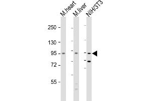 All lanes : Anti-Insr Antibody  at 1:2000 dilution Lane 1: mouse heart lysate Lane 2: mouse liver lysate Lane 3: NIH/3T3 whole cell lysate Lysates/proteins at 20 μg per lane. (Insulin Receptor antibody  (AA 1325-1358))