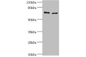 Western blot All lanes: Protein-glutamine gamma-glutamyltransferase 2 antibody at 8 μg/mL Lane 1: Hela whole cell lysate Lane 2: HepG2 whole cell lysate Secondary Goat polyclonal to rabbit IgG at 1/10000 dilution Predicted band size: 78, 62, 39 kDa Observed band size: 78 kDa (Transglutaminase 2 antibody  (AA 438-687))