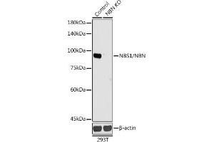 Western blot analysis of extracts from normal (control) and NBS1/NBS1/NBN knockout (KO) 293T cells, using NBS1/NBS1/NBN antibody (ABIN1681204, ABIN3015326, ABIN3015327 and ABIN5663771) at 1:1000 dilution. (Nibrin antibody  (AA 435-754))
