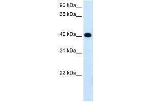 WB Suggested Anti-ADH4 Antibody Titration:  1. (ADH4 antibody  (Middle Region))