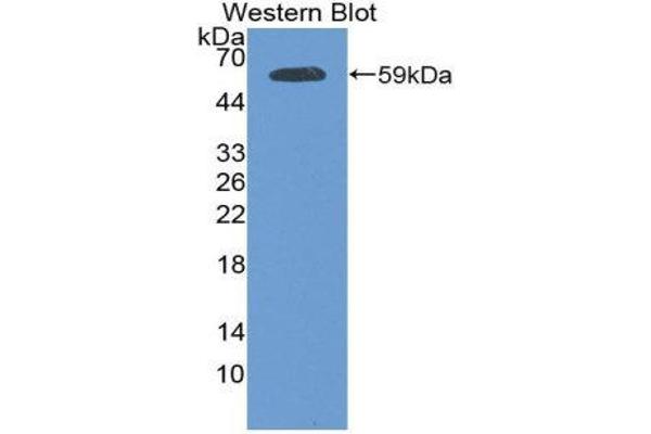 Plakophilin 1 antibody  (AA 500-742)