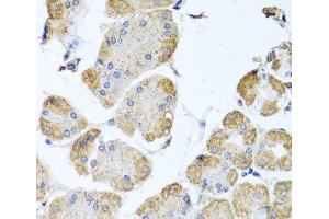 Immunohistochemistry of paraffin-embedded Human stomach using ITPKB Polyclonal Antibody at dilution of 1:100 (40x lens). (ITPKB antibody)