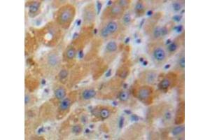 Used in DAB staining on fromalin fixed paraffin-embedded Liver tissue (MBL2 antibody  (AA 129-244))