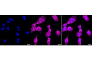 anti-Muscleblind-like Protein 1 (MBNL1) antibody