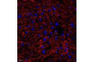Immunofluorescence of paraffin embedded human liver using B0K (ABIN7073200) at dilution of 1:750 (400x lens) (BOK antibody)