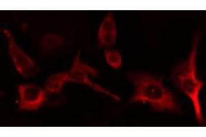 ABIN6266922 staining HT29 cells by IF/ICC.