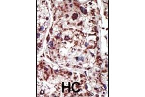 Immunohistochemistry (Paraffin-embedded Sections) (IHC (p)) image for anti-Protein Kinase C and Casein Kinase Substrate in Neurons 1 (PACSIN1) (AA 8-38) antibody (ABIN392665)