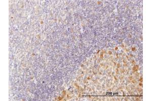 Immunoperoxidase of purified MaxPab antibody to C10orf7 on formalin-fixed paraffin-embedded human tonsil. (CDC123 antibody  (AA 1-336))