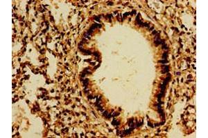 Immunohistochemistry of paraffin-embedded human lung tissue using ABIN7167505 at dilution of 1:100 (PTPRF antibody  (AA 688-970))
