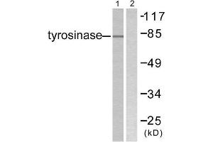 Western Blotting (WB) image for anti-Tyrosinase (TYR) (C-Term) antibody (ABIN1848871) (TYR antibody  (C-Term))