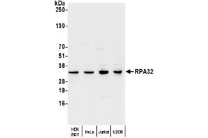 Western Blotting (WB) image for anti-Replication Protein A2, 32kDa (RPA2) (C-Term) antibody (ABIN7454599) (RPA2 antibody  (C-Term))