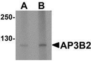 Western blot analysis of AP3B2 in rat brain tissue lysate with AP3B2 antibody at (A) 1 and (B) 2 µg/ml.