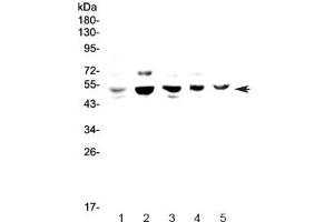 Western blot testing of 1) human HeLa, 2) rat PC-12, 3) mouse lung, 4) mouse ovary and 5) mouse HEPA1-6 lysate with NFIB antibody at 0. (NFIB antibody)