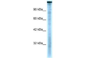 WB Suggested Anti-TAF1 Antibody Titration:  0. (TAF1 antibody  (C-Term))
