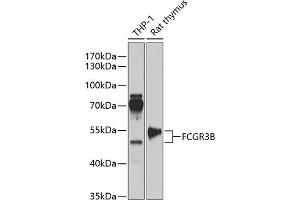 Western blot analysis of extracts of various cell lines, using FCGR3B antibody (ABIN6131279, ABIN6140548, ABIN6140550 and ABIN6218175) at 1:1000 dilution. (FCGR3B antibody  (AA 1-233))