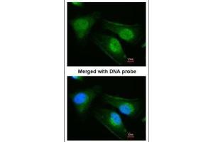 ICC/IF Image Immunofluorescence analysis of paraformaldehyde-fixed HeLa, using DNAJB6, antibody at 1:200 dilution. (DNAJB6 antibody  (Center))