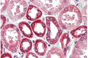 Human Kidney (formalin-fixed, paraffin-embedded) stained with BECN1 antibody ABIN461895 at 5 ug/ml followed by biotinylated goat anti-rabbit IgG secondary antibody ABIN481713, alkaline phosphatase-streptavidin and chromogen.