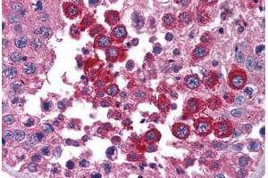 Human Testis (formalin-fixed, paraffin-embedded) stained with STAT4 antibody ABIN239852 at 1:50 followed by biotinylated goat anti-rabbit IgG secondary antibody ABIN481713, alkaline phosphatase-streptavidin and chromogen. (STAT4 antibody  (N-Term))