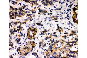 Anti-Human Milk Fat Globule 1 antibody, IHC(P) IHC(P): Human Mammary Cancer Tissue (MFGE8 antibody  (Middle Region))