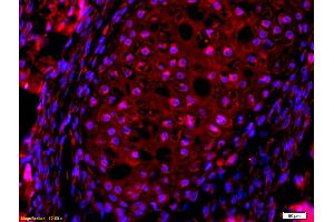 Formalin-fixed and paraffin embedded mouse embryo labeled with Anti-AQP7 Polyclonal Antibody, Unconjugated (ABIN741255) at 1:200, overnight at 4°C, The secondary antibody was Goat Anti-Rabbit IgG, Cy3 conjugated used at 1:200 dilution for 40 minutes at 37°C. (Aquaporin 7 antibody  (AA 251-342))