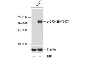 Western blot analysis of extracts from A431 cells using Phospho-GRIN2B(Y1474) Polyclonal Antibody. (GRIN2B antibody  (pTyr1474))
