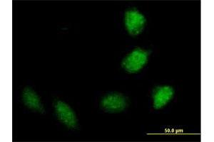 Immunofluorescence of purified MaxPab antibody to TRIM40 on HeLa cell. (TRIM40 antibody  (AA 1-258))