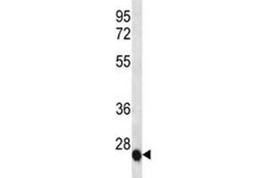 IL-6 antibody western blot analysis in NCI-H460 lysate (IL-6 antibody  (AA 27-55))